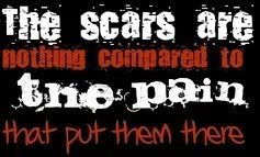 scars Pictures, Images and Photos
